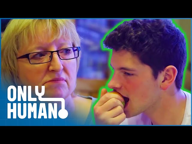 His Teeth Are So Tiny He Cannot Bite an Apple | Extreme Teeth Grinding