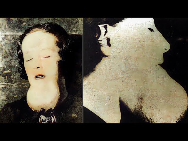 Twisted Human Experiments - Radiation