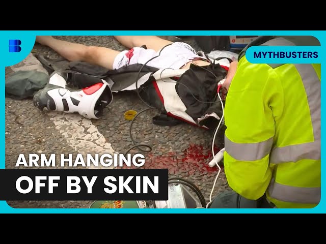 Motorcyclist Loses Arm in A47 Crash Rescue | Air Ambulance ER