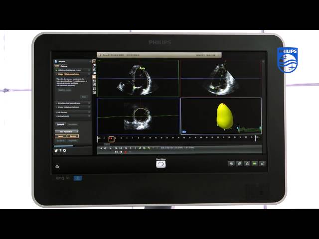 How To Perform 3D Quantification Using Philips QLAB 3DQA Application