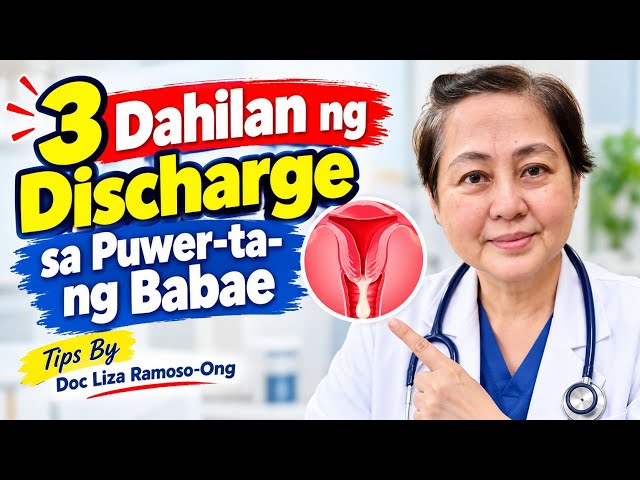 3 Dahilan ng Discharge sa Puwer-ta- ng Babae. - Tips By Doc Liza Ramoso-Ong