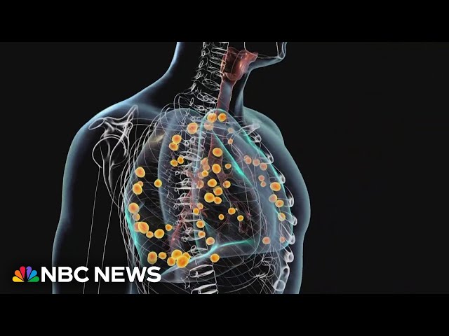 Mysterious illness sickens dozens in Tennessee