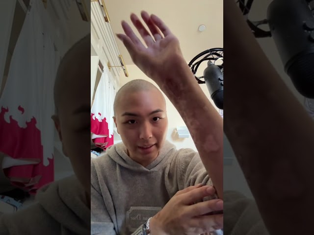 Once more #cancer #leukemia #journey #Shorts #kevinliu_05