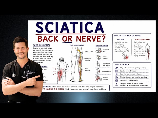 Sciatica Explained | Why Back Pain Travels Down Your Leg