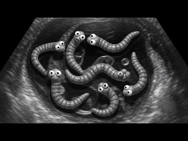 What Happens Inside Your Stomach? | Parasite Worms Under Ultrasound Animation