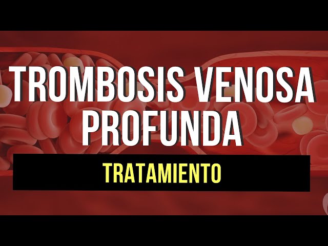 Trombosis venosa profunda | Tratamiento (Parte 2)🩸