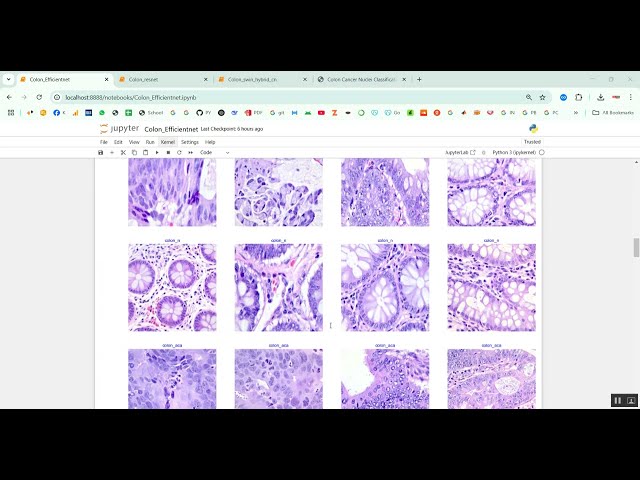 Colon Cancer Nuclei Classification in Python Projects