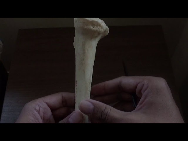 TIBIA - GENERAL FEATURES AND ATTACHMENTS