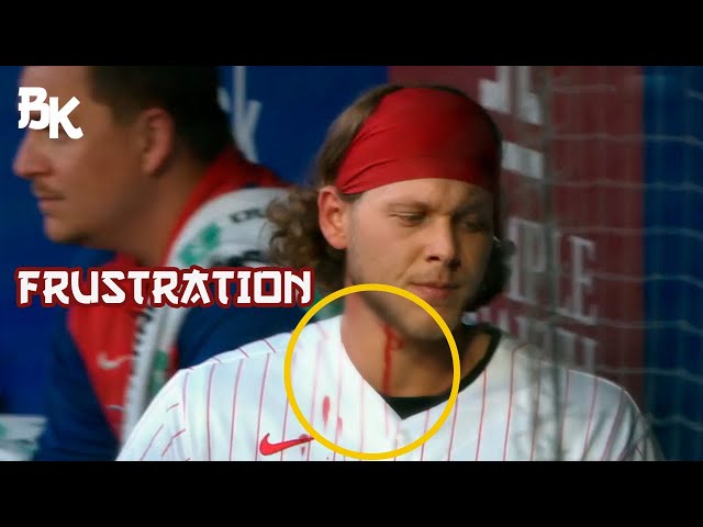 MLB - Unpleasant Frustrations