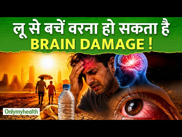 Heatwave Alert : लू से हो सकता है Brain Damage और Vision Loss! I Only My Health