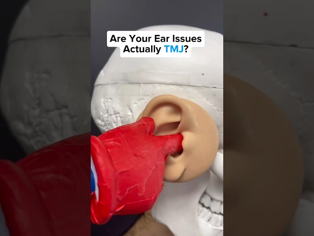 Are your ear issues actually TMJ? Watch this to find out! #earache #tmj #tmjtreatment #tmjdisorder