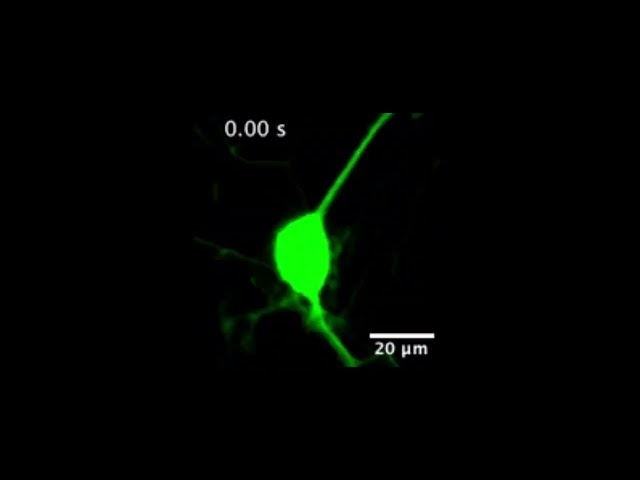 New nanosensor gives unprecedented look at dopamine release