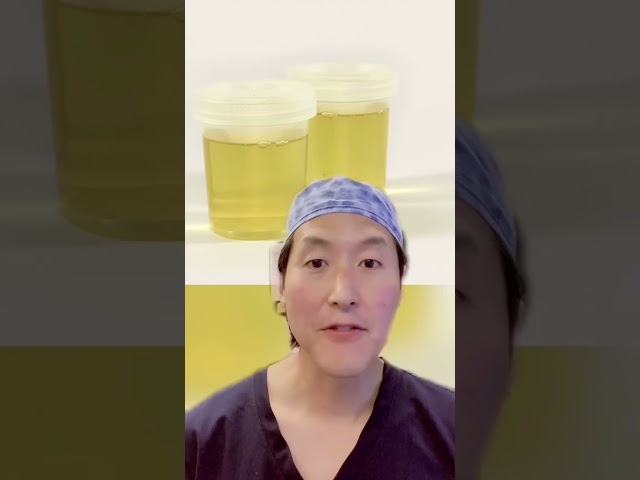What Happens if You Drink Pee? Urine Therapy?!?! 😳😳 #shorts