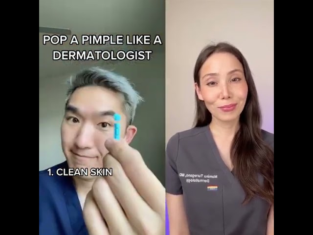 How to Pop a Pimple Like a Dermatologist