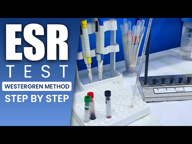 How to Perform ESR Test Step by Step | Westergren Method Tutorial | MedilabLife