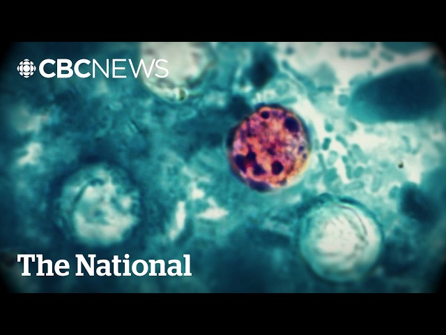 Explosive diarrhea-causing parasite infects more than 1,000 people in U.S.