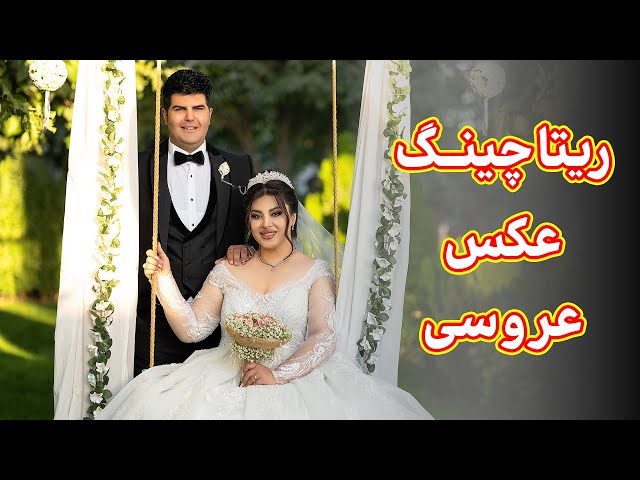 ریتاچینگ عکس ودینگ بدون تخریب پوست
