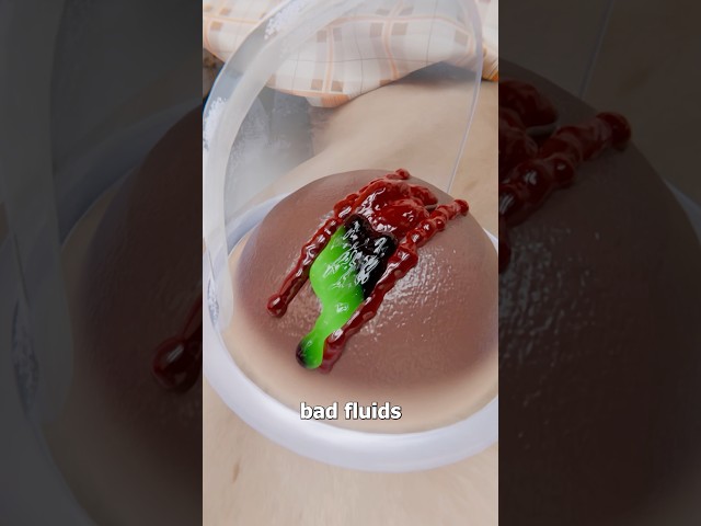 How This Suction Cup Therapy Works 🤔 Surgeon Reacts