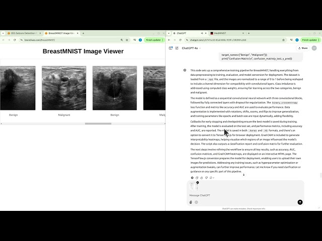 Optimizing BreastMNIST Model: Training, Deployment & Performance Insights