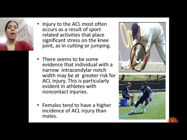 ACL injury by Dr Kirti Chhabra|Physiotherapy| RPIIMS