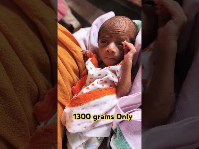 1300grams Preterm Newborn Baby #preterm #Newborn #1300 grams #shorts
