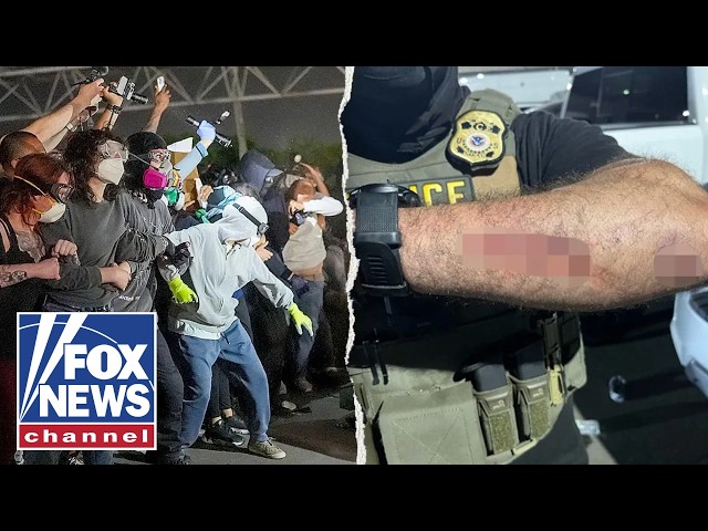 Rioter charged for BITING ICE officer, Blanche announces