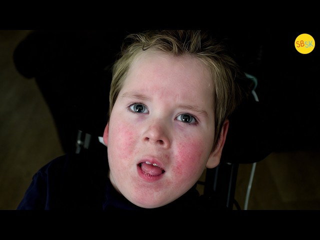A Baby Permanently Disabled by Abuse