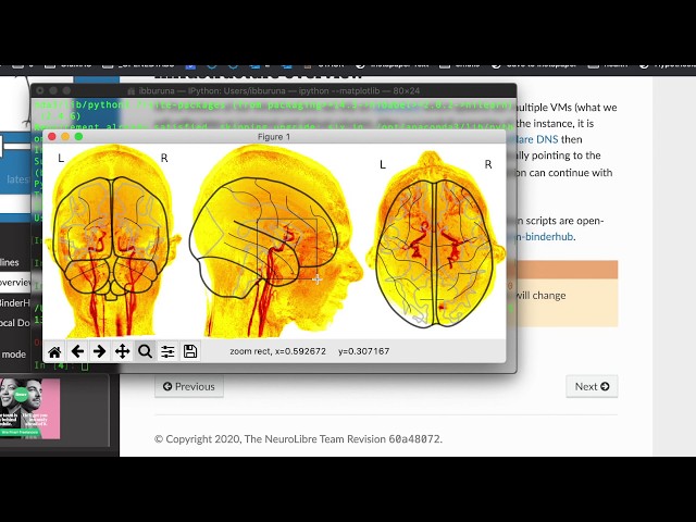 Nilearn: Machine learning for Neuro-Imaging in Python