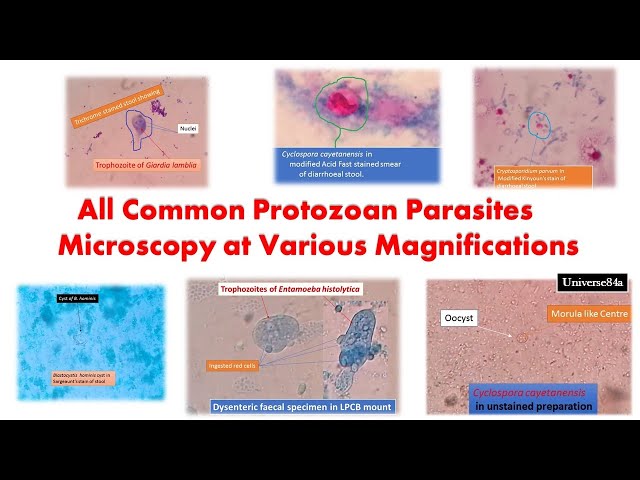All Common Protozoan Parasites under the Microscope/ Giardia/Amoeba/ Trichomonas/Cyclospora/Cryptosp