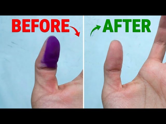 Remove All Ink From Hand INSTANTLY! 🔥 (Secret Trick!)