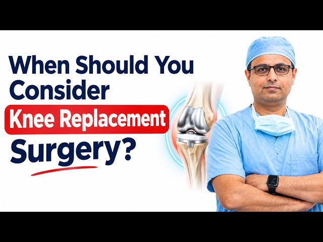 When Should You Consider Knee Replacement Surgery? | How to Make the Right Decision?