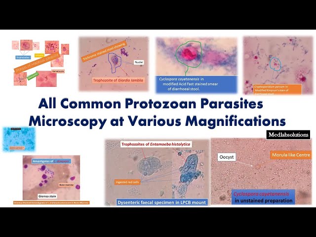 All Common Protozoal Parasites Microscopy