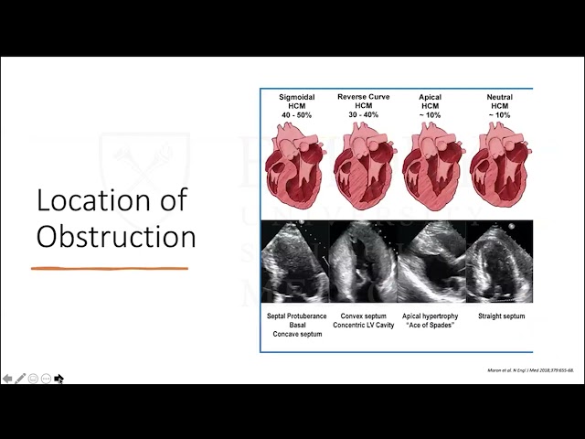 HCM Unobstructed: A Fellows Guide