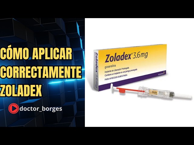 How to inject Zoladex (goserelin)