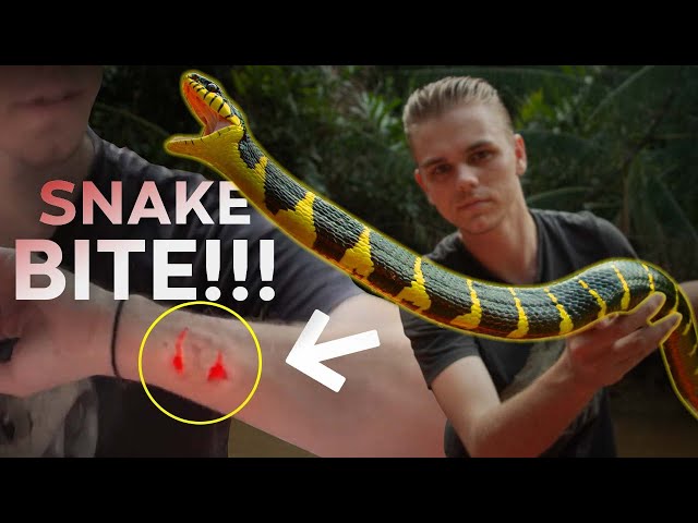 I GOT BITTEN - VENOMOUS?