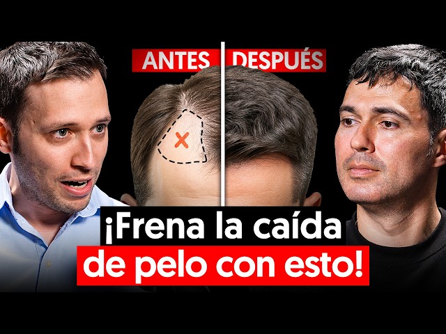Dr. Experto en Pelo: Evita la calvicie y recupera tu pelo con estos simples pasos