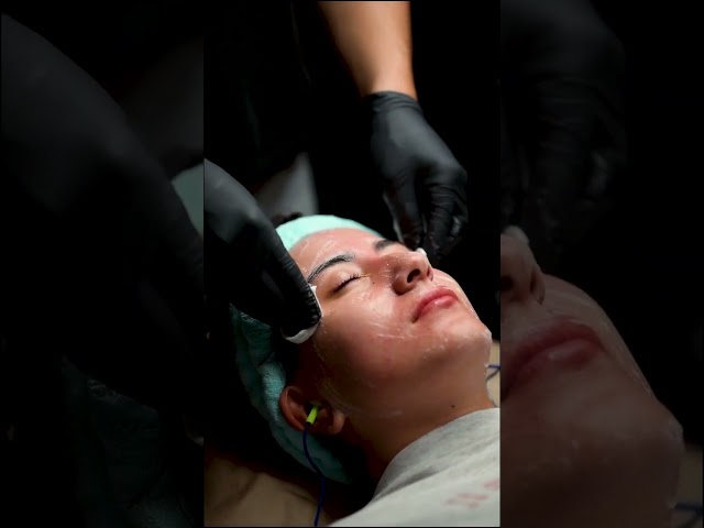Microcurrent Facial: The Needle-Free Lift for Firmer, Defined Skin