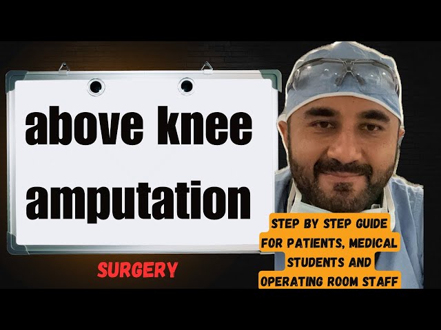 What to Expect for above knee amputation Surgery 😳(guide) A must see ❤️ #surgery #vascular