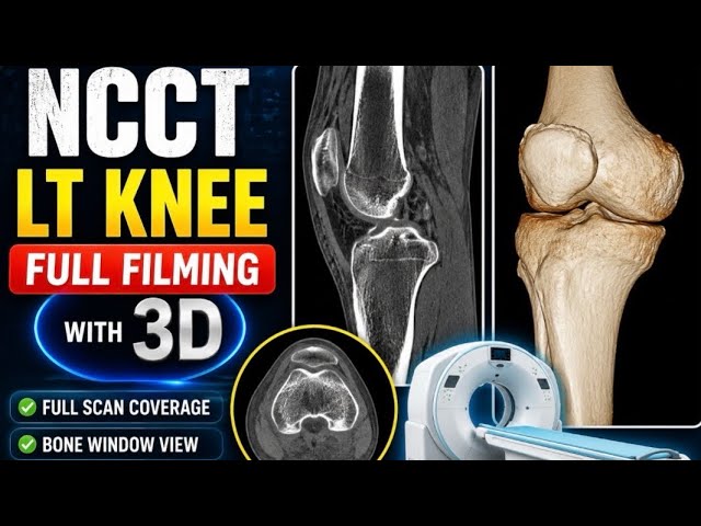 NCCT Left Knee Full Filming // GE Machine