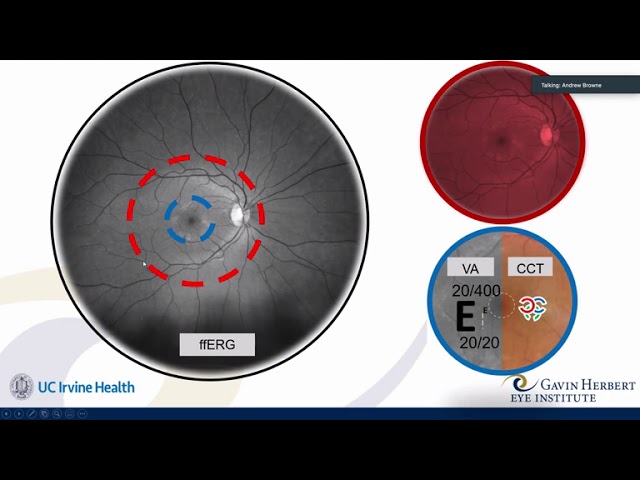 Measuring Static Visual Function With Visible and ‘Invisible’ Light, Andrew W. Browne MD, PhD - UCI