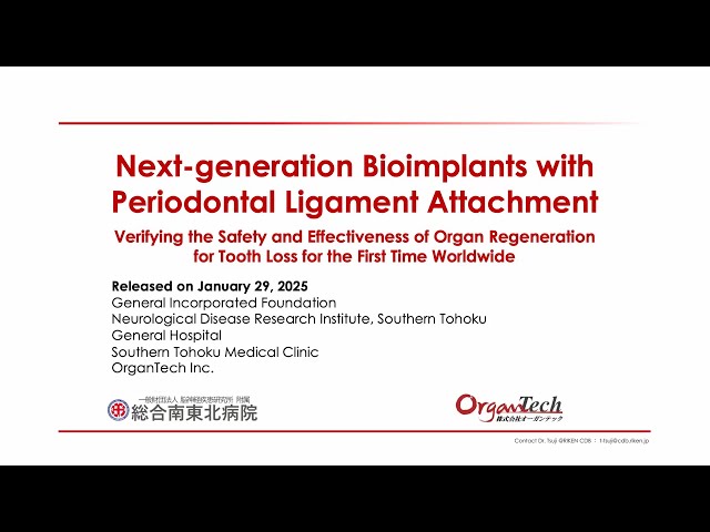 Next generation Bioimplants with Periodontal Ligament Attachment Jan 29th 2025