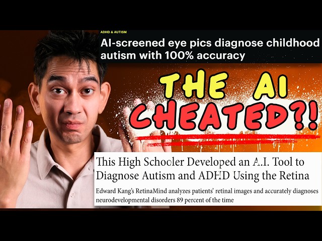 Can AI Really Diagnose Autism From a Photo of Your Eye?