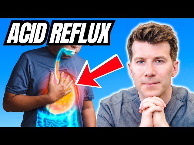 Burning sensation after eating? Doctor explains Acid Reflux in Adults | Causes, Symptoms, Treatment