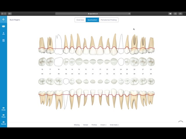 6. Quickselect mode – derec® application walkthrough