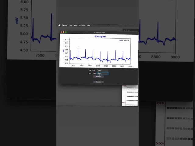 ECG signal Processing via Python