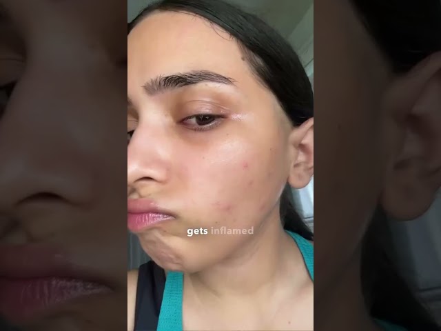 Pregnent🤰#hospital #mbbsstudent #rakshitasingh #doctor #ytshorts #trending #mbbslife #pregnant