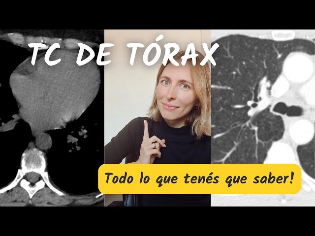 Chest CT scan ☢️ 🩺: Everything you need to get started!