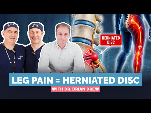 How to Treat Sciatica Explained By Spine Surgeon Dr Brian Drew