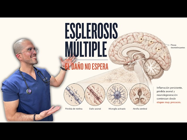 Multiple Sclerosis does NOT begin when symptoms appear (Masterclass)