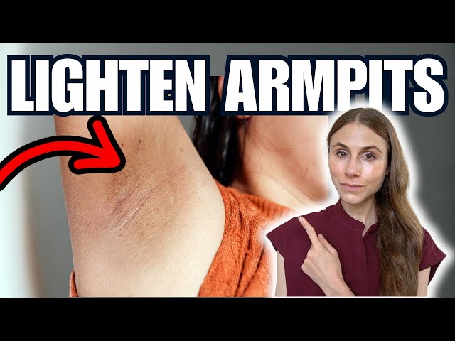 How to Lighten Dark Armpits FAST – Dermatologist Tips That Actually Work!